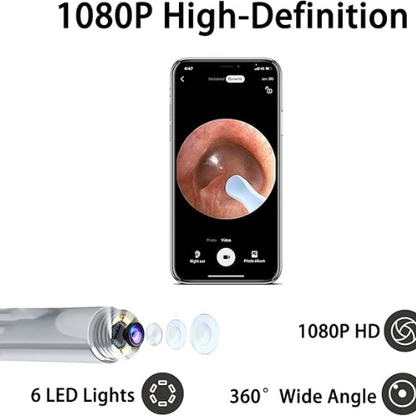 Limpiador de Oídos Profesional con Cámara